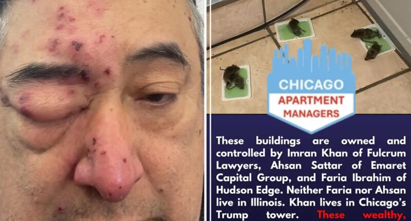 Chicago tenant says he woke up to rats gnawing on his face