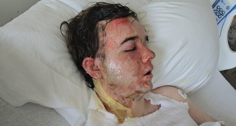 McDonald's manager left with burns after OIL thrown at him