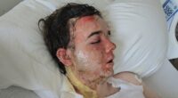 McDonald's worker scalded by burning oil that colleague threw at him