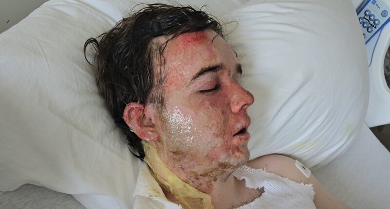 McDonald's worker scalded by burning oil that colleague threw at him