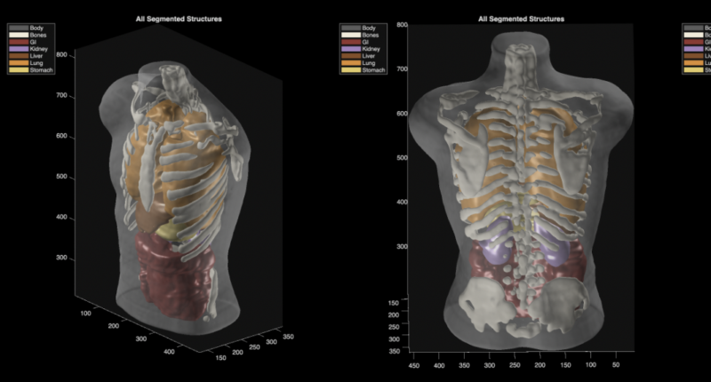 Midjourney Medical goes from AI image generation to full-body ultrasounds