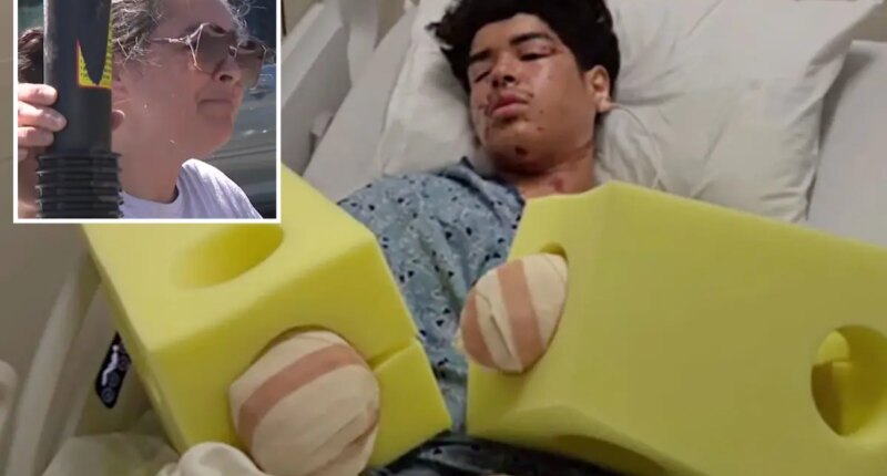 California mom goes ballistic after teen son's hands are blown to pieces on 4th of July