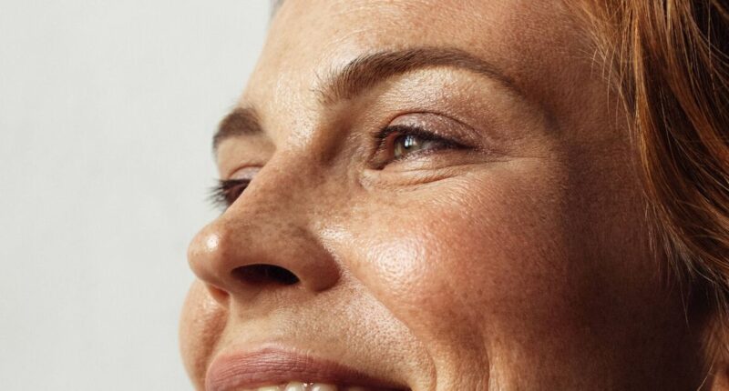 Doctor explains real reason freckles get darker in summer