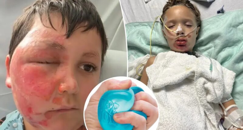 Doctor warns viral NeeDoh toy trend is hospitalizing children with severe burns