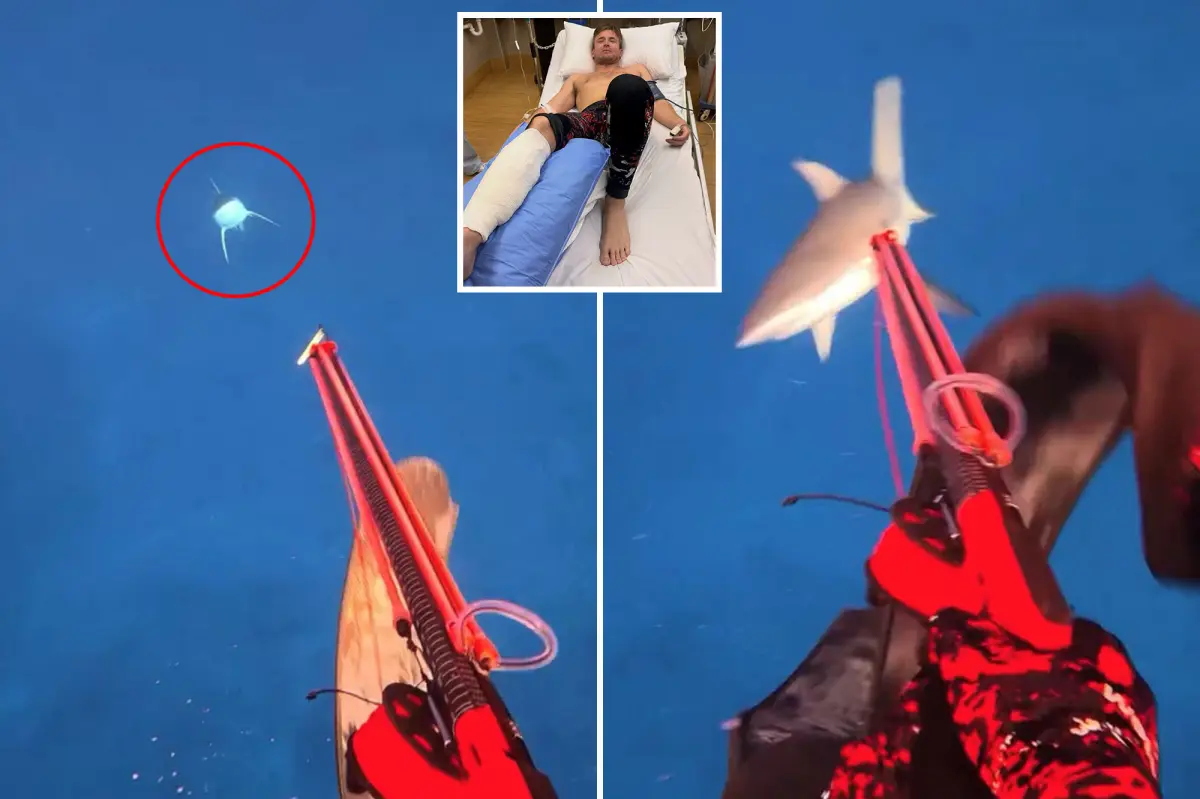 Influencer Survives Brutal Shark Attack Caught on Camera, Nearly Loses Leg - Internewscast Journal