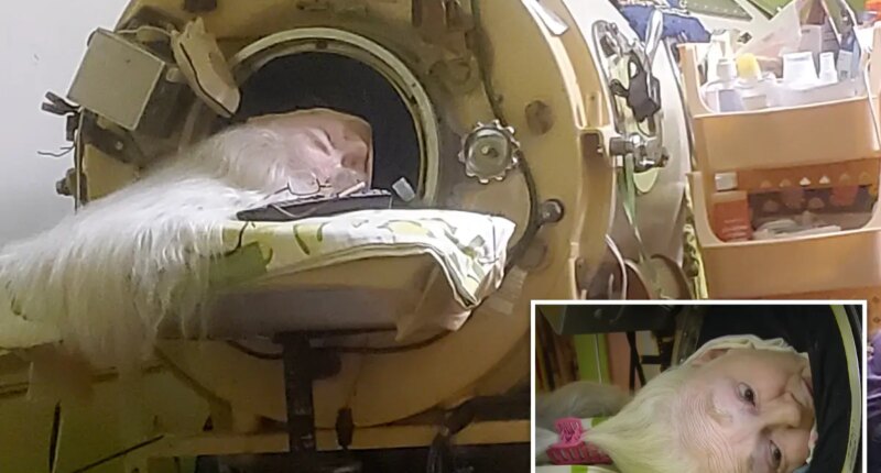 Martha Lillard, last US polio patient using iron lung, dead at 78 in Oklahoma