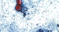 Parasite outbreak causing 'explosive diarrhea' reported in 17 US states, CDC warns