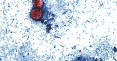 Parasite outbreak causing 'explosive diarrhea' reported in 17 US states, CDC warns