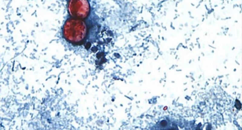 Parasite outbreak causing 'explosive diarrhea' reported in 17 US states, CDC warns
