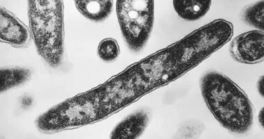 Second death reported in Legionnaires' disease outbreak in New York City