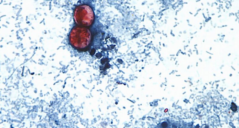 What we still don't know about the cyclosporiasis outbreak as cases rise