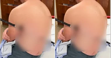Montana Hiker Impaled by Trekking Pole Treks Out for Help - Internewscast Journal
