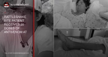 Rattlesnake Bite Patient Receives 20 Doses of Antivenom at Southern California Trauma Center - Internewscast Journal