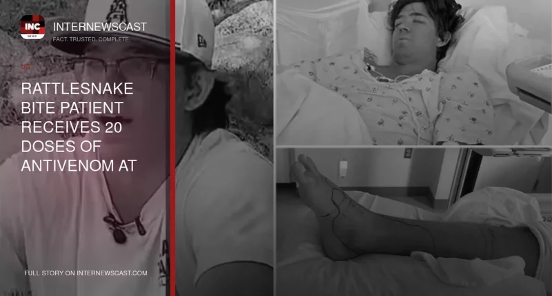 Rattlesnake Bite Patient Receives 20 Doses of Antivenom at Southern California Trauma Center - Internewscast Journal