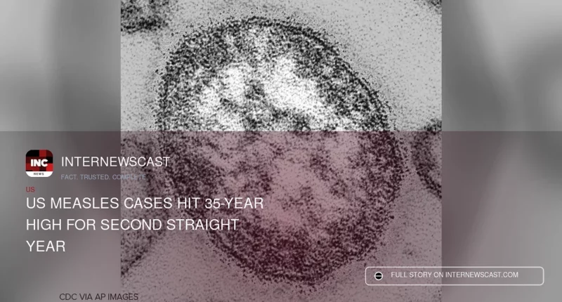 US Measles Cases Hit 35-Year High for Second Straight Year - Internewscast Journal