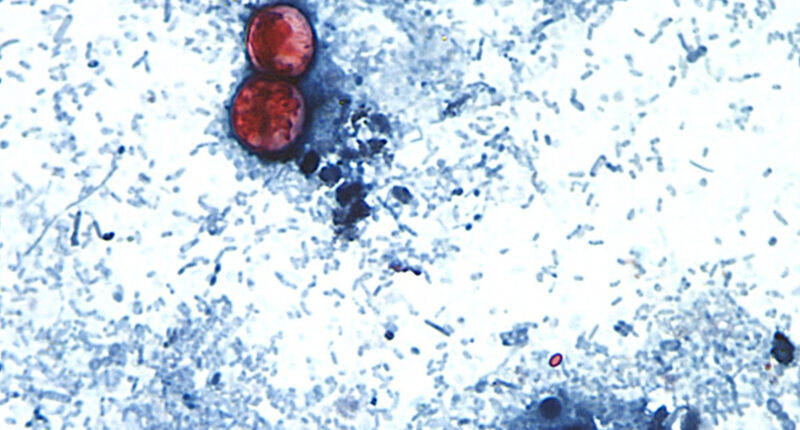 2 deaths reported in cyclosporiasis outbreak in Michigan as cases surpass 11,000