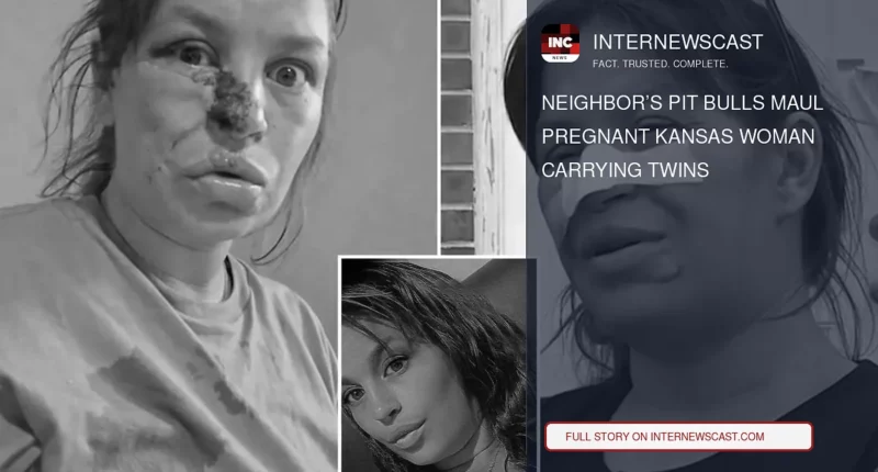 Neighbor’s Pit Bulls Maul Pregnant Kansas Woman Carrying Twins - Internewscast Journal