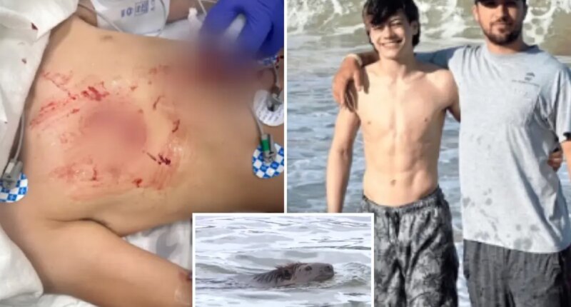 Boy attacked by rabid beaver at Cunningham Falls State Park undergoes multiple surgeries