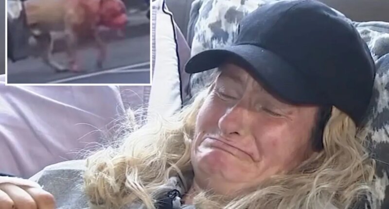 SF woman mauled by pit bull speaks out after surviving attack