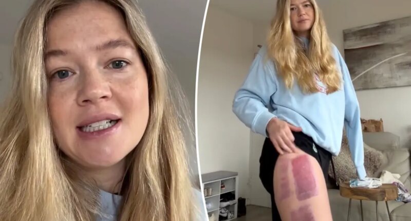 Shark attack survivor who lost an arm shares sad health news