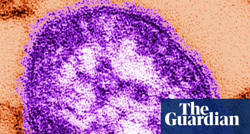 Six-week-old child in Pennsylvania died from measles, coroner says