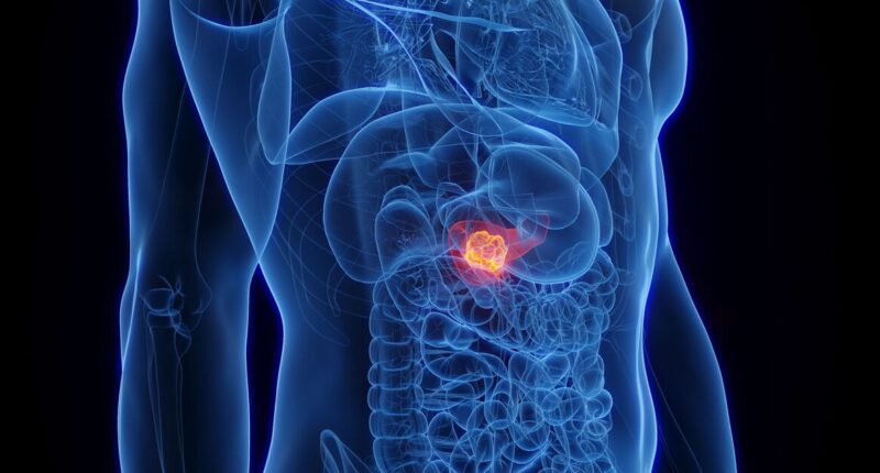 The 7 easily missed 'warning signs' of 'terrifyingly deadly' pancreatic cancer