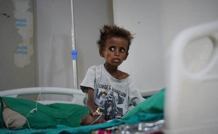 Yemen’s civil war returns and overwhelms hospitals with 'a very dangerous situation'
