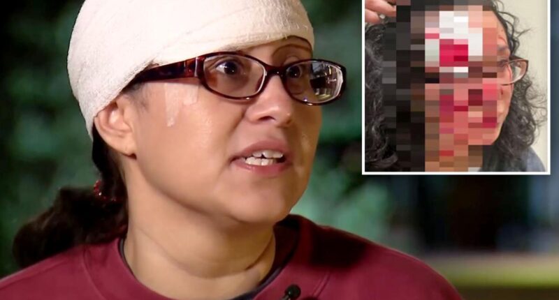 ‘Zombie’ allegedly bites chunk out of victim’s head in West Coast attack