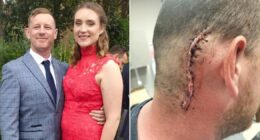 I’m selling my house to fight incurable brain cancer — the drug will cost at least £16,000