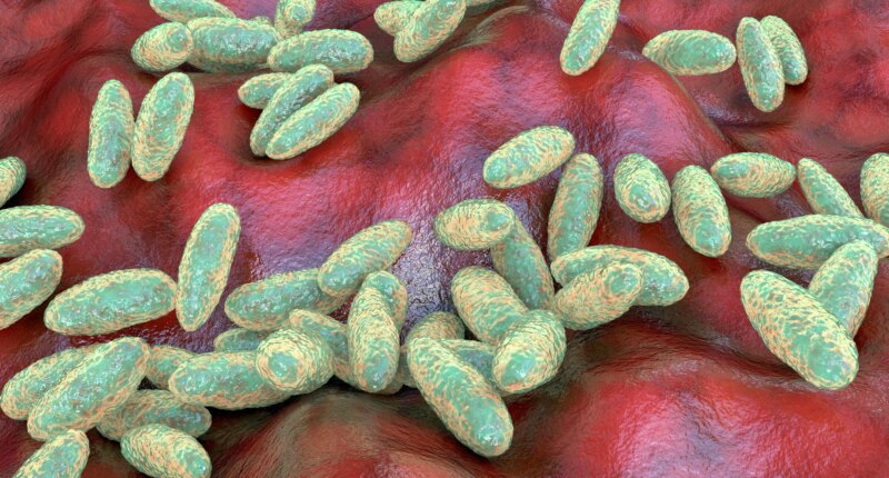 US monitoring suspected fatal pneumonic plague case in Russia, State Department official says