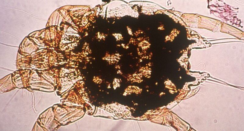 Victorian disease rips through UK town forcing hospital wards to close